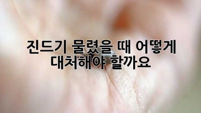 진드기 물렸을 때, 어떻게 대처해야 할까요?